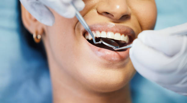 Best Emergency Root Canal Treatment in Devens, MA